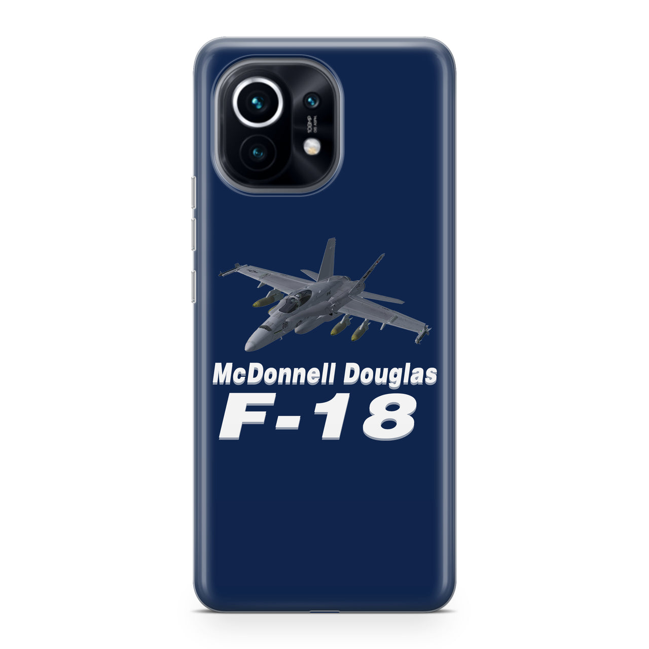 The McDonnell Douglas F18 Designed Xiaomi Cases