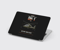 Thumbnail for Kawasaki OH-1 design on black MacBook case