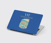 Thumbnail for Vitoria Airport (VIT) design on blue MacBook case