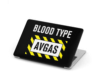 Thumbnail for Blood Type AVGAS aviation design on MacBook case for MacBook.
