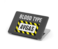 Thumbnail for Blood Type AVGAS MacBook Case - view 4
