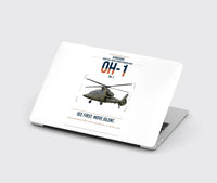 Thumbnail for Kawasaki OH-1 design on white MacBook case