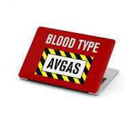 Thumbnail for Blood Type AVGAS MacBook Case - view 7