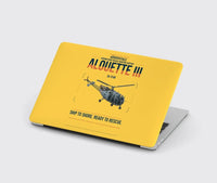 Thumbnail for Aérospatiale SA 316B Alouette III design on yellow MacBook case