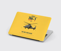 Thumbnail for Kawasaki OH-1 design on yellow MacBook case