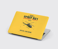 Thumbnail for Westland Scout AH1 design on yellow MacBook case