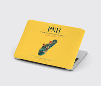 Thumbnail for Phnom Penh International Airport (PNH) design on yellow MacBook case