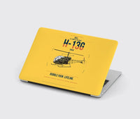 Thumbnail for Bell H-13G Sioux design on yellow MacBook case