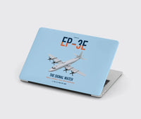 Thumbnail for EP-3E ARIES II design on light blue MacBook case