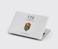 Thumbnail for Wattay International Airport Vientiane (VTE) design on light gray MacBook case