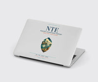 Thumbnail for Nantes Atlantique Airport (NTE) design on light gray MacBook case