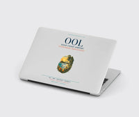 Thumbnail for Gold Coast Airport (OOL) design on light gray MacBook case
