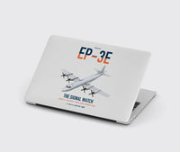 Thumbnail for EP-3E ARIES II design on light gray MacBook case