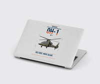 Thumbnail for Kawasaki OH-1 design on light gray MacBook case