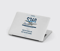 Thumbnail for Shorts 360-300 design on light gray MacBook case