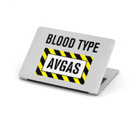 Thumbnail for Blood Type AVGAS Designed Macbook Cases