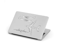 Thumbnail for Antonov AN-225 (14) Designed Macbook Cases